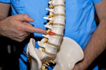 Because the back hurts in the lower back and what to do