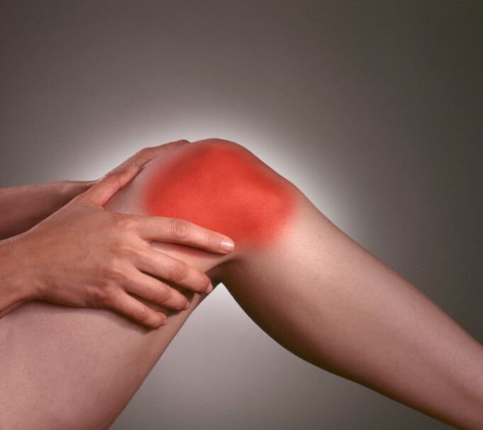 Inflammation in the knee joint with arthrosis