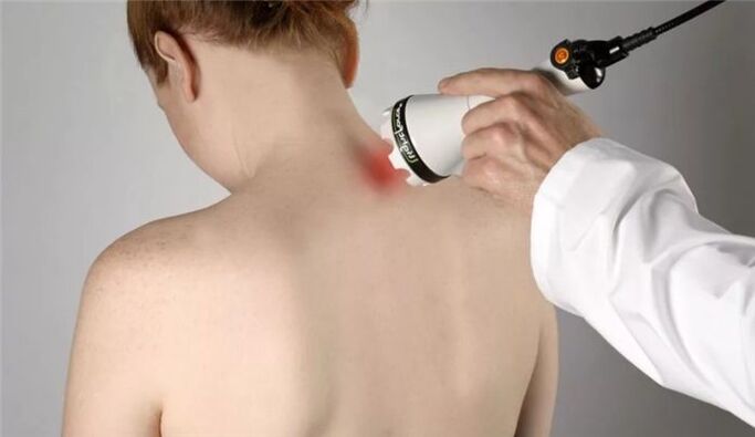 physiotherapy for the treatment of cervical osteochondrosis