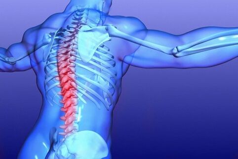 osteochondrosis of the lumbar spine