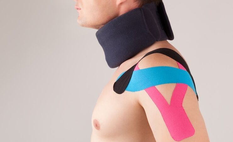 During the acute period of cervical osteochondrosis, it is necessary to wear a special collar